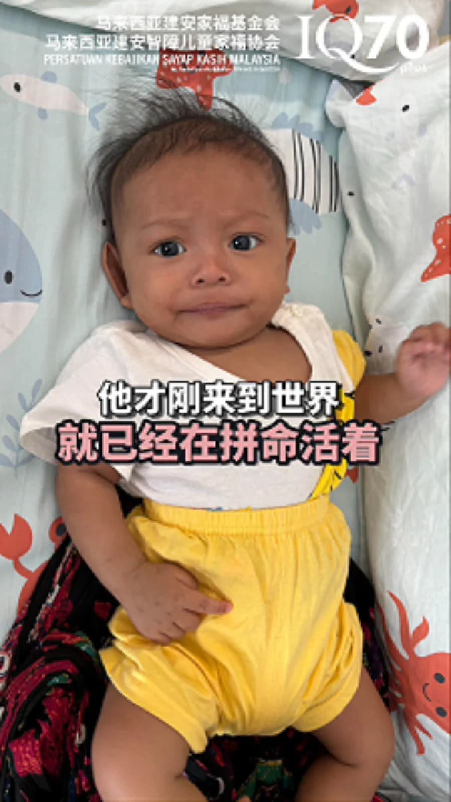 Fundraising Case No. 74 | Raising RM40,000 for Yoan Ivander Yogil's Ventricular Septal Defect (VSD) and right coronary cusp prolapse surgery.